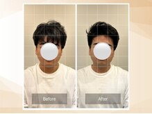 エモア メディカル整体院 恵比寿院(Emoa)/【30代男性】小顔矯正
