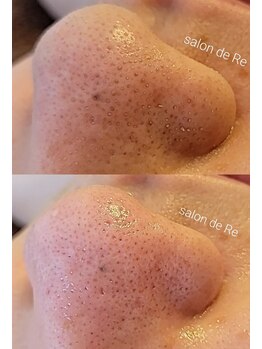 サロンドリー(salon de Re)/超音波エクストラクション