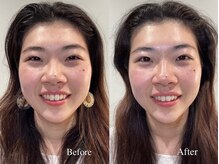 キャピタル(CAPITAL)の雰囲気（自律神経から整え、頭蓋骨を正しい位置に引き締める小顔矯正★）