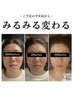 【小顔頭蓋骨矯正＋オイル＋美肌美顔器8回モニターコース】¥167,200→¥64,000