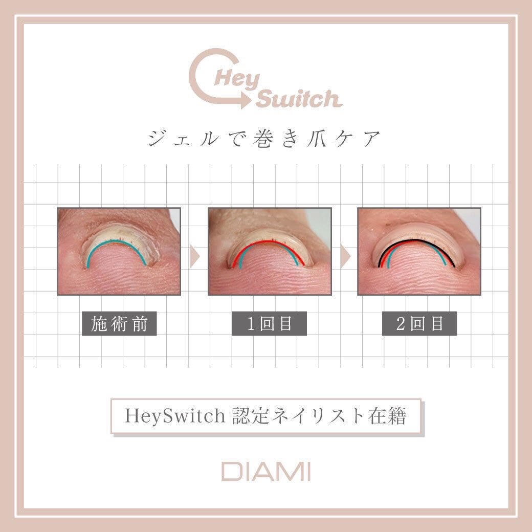 heyswitch 巻き爪 3点セット 新メニュー 巻爪ケア 特殊ジェル