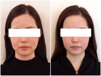 美容整体 ウェリナ 蟹江院/小顔矯正/骨盤矯正/美脚サロン