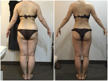 美容整体 ウェリナ 蟹江院/小顔矯正/骨盤矯正/美脚サロン