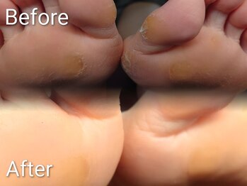 エンネイル(en.nail)/30代 女性