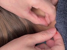 アオヤマ サロン ワイゼット(AOYAMA SALON YZ)の雰囲気(国産の使い捨て鍼を使用。美容鍼や鍼灸が初めての方にも◎)