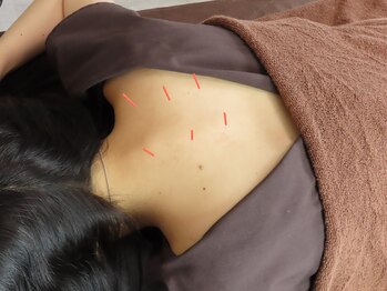 いとう鍼灸整体院 代官山恵比寿/首肩こりへのアプローチ