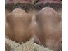 【メンズ肌専用!テカリ/脂性肌/肌荒れ改善コース】毛穴吸引＋W酵素で角質分解