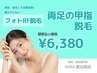 【都度払い】　両足の甲指脱毛　¥6,380‐