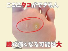 ニコ(niko)/ここにタコがある方！！