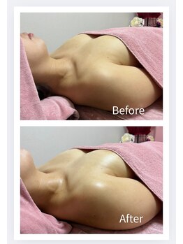 チュラ 大宮店(Chura)/卒乳後の自信復活!(2/2)大宮