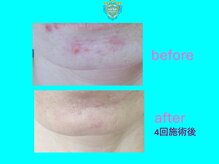 リュクス(LUXE)/ビフォーアフター