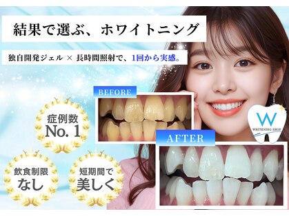 ホワイトニングショップ 本厚木店の写真