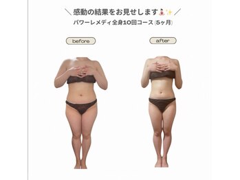 ビループ(biloop)/圧倒的な結果を。