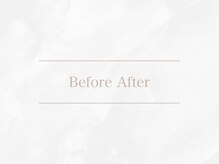 トゥルーアイ マークイズ みなとみらい店(TRU EYE)/Before　After