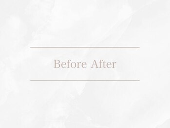 トゥルーアイ マークイズ みなとみらい店(TRU EYE)/Before　After