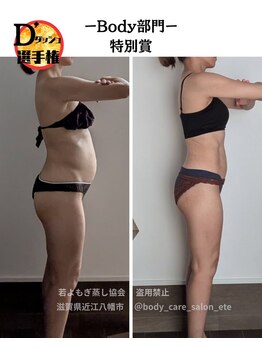 リレフー(Relafy)/★痩身★