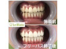 ルブラン 奈良店(Le Blanc)/通うほどお得！