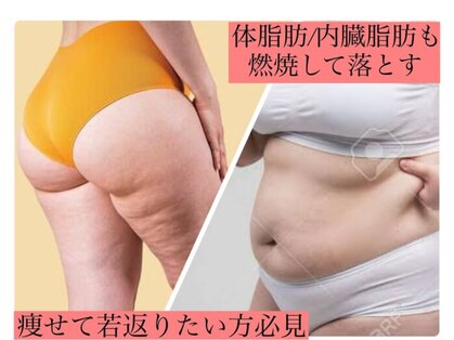 ヨサパーク モア(YOSAPARK MORE)の写真