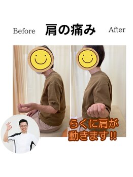 三条かがやき整体院/肩の痛み改善