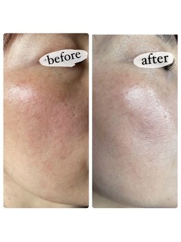 アイラッシュ ミル 御領店(eye lash Miru)/ダウンタイムあり!効果即実感!