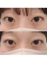 ジュエリーアイラッシュ(Jewelry eyelash)/ラッシュリフト