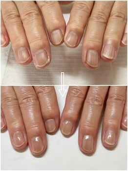 ネイルケア（補強コート付き）