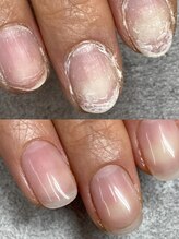 ボンテ 新宿店/ネイルケア