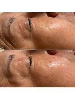 レアリゼ(Realiser)/クリスティーナ