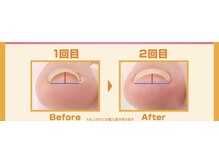 プティ ネイル(Petite nail)の雰囲気（おすすめ！地域で唯一の巻き爪改善ジェル！）