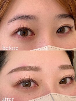 イーズ(ease.)/コスメリフト