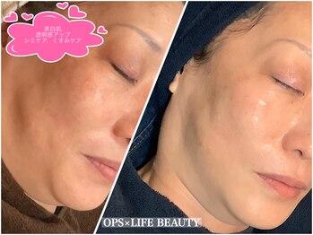 オプス ライフビューティー(OPS×LIFE BEAUTY)/シミケア、くすみケア☆