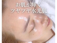 ミセル(MISEL2nd)の雰囲気（【韓国発★水光肌ピーリング】肌の角質オフ！ツヤツヤゆで卵肌に）