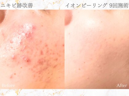 アクール(Accueil)の写真