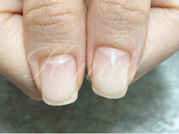 ケーネイル(K.nail)の写真/《丁寧なケアで自爪を美しく》丁寧かつ適切なケアを行うことで健康的な自爪を育てます◎