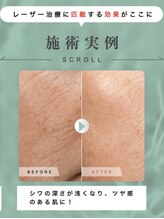 クロエココ(Chloe.cocoo)/お悩みランキング1位/美肌編