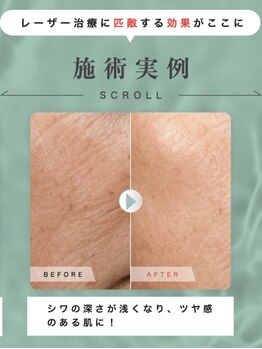 クロエココ(Chloe.cocoo)/お悩みランキング1位/美肌編