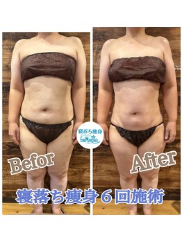 エネマリーナ(Enemariina)/