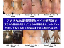 ザ ベッピン(the 別嬪)の雰囲気（特別モニター募集中【@beppin_facecare】）