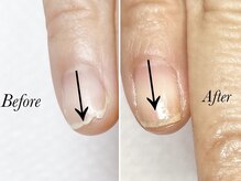 トゥインクリーネイルサロン(Twinkly Nail Salon)/【地爪育成】1回お試し
