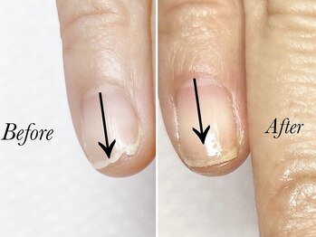 トゥインクリーネイルサロン(Twinkly Nail Salon)/【地爪育成】1回お試し