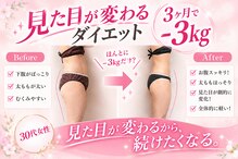 ヨサパーク エルメ 経堂(YOSA PARK Herme)