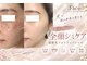 ドットフェイス(.Face)の写真