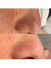 ベリーベリー 九条店(VERY-VERY)/