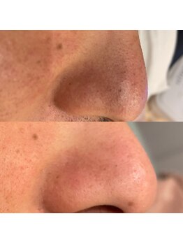 ベリーベリー 九条店(VERY-VERY)/