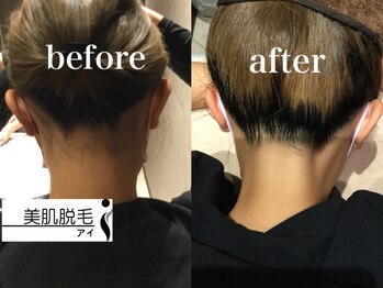 アイスタイル(i-style)/うなじ美人へ♪