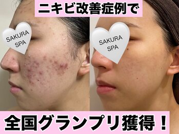 サクラ スパ エステティック(SAKURA SPA esthetics)