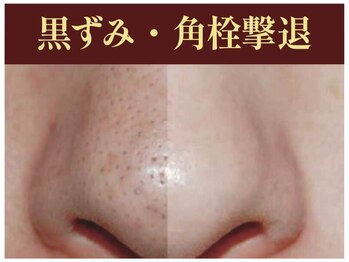 ラナビューティリゾート(Lana Beauty resort)/施術後はつるんと感動♪