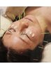 【顔のたるみ改善/目の疲れ解消】美容鍼+ヘッド・デコルテマッサージ70分 