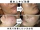 バリマ ビューティー(Bali Ma'beauty)の写真