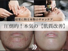 アングレイス(Anngrace)の雰囲気（【技】と【真ごころ】で今までにない効果実感をお届けします）